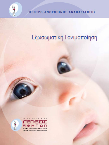 ivf