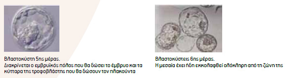 embryometafora blastokisteon