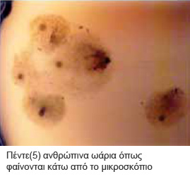 oolipsia